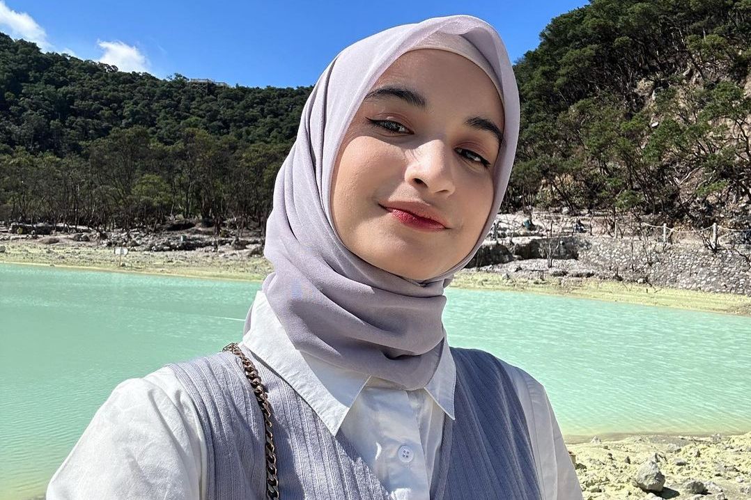 Profil Biodata Cut Intan Nabila, Selebgram yang Menjadi Korban KDRT Suami